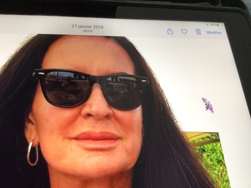 Customer photo review of Sarahbio - huile de pépins de figue de barbarie - 30 mL