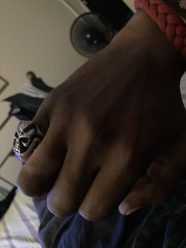 Customer photo review of Snake Bite Skull Ring