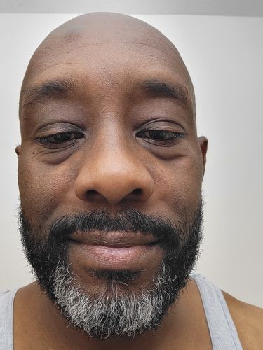 Customer photo review of Respected Roots Beard Hydration Kit