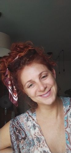 Customer photo review of Ginger Green Contact Lenses(12 months wear)