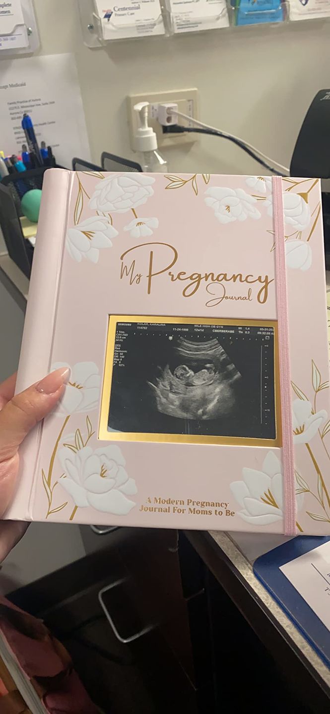 Customer photo review of Pregnancy Journal (Blossom)