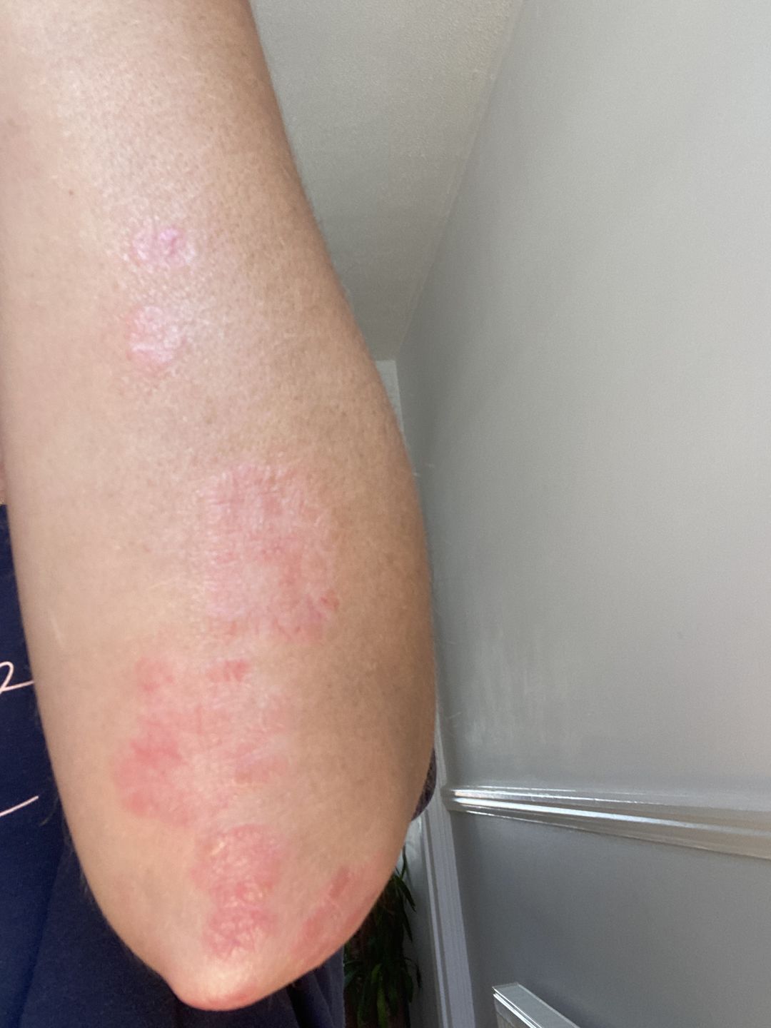 Customer photo review of Intensive Night Balm