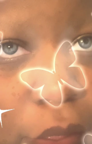 Customer photo review of Himalaya Blue Contact Lenses(12 months of use)