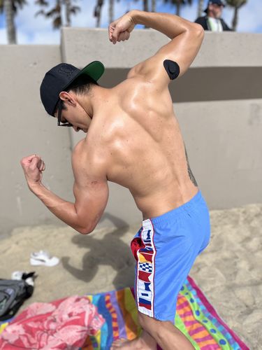 Customer photo review of Skin Grip Freestyle Libre Adhesive Patches