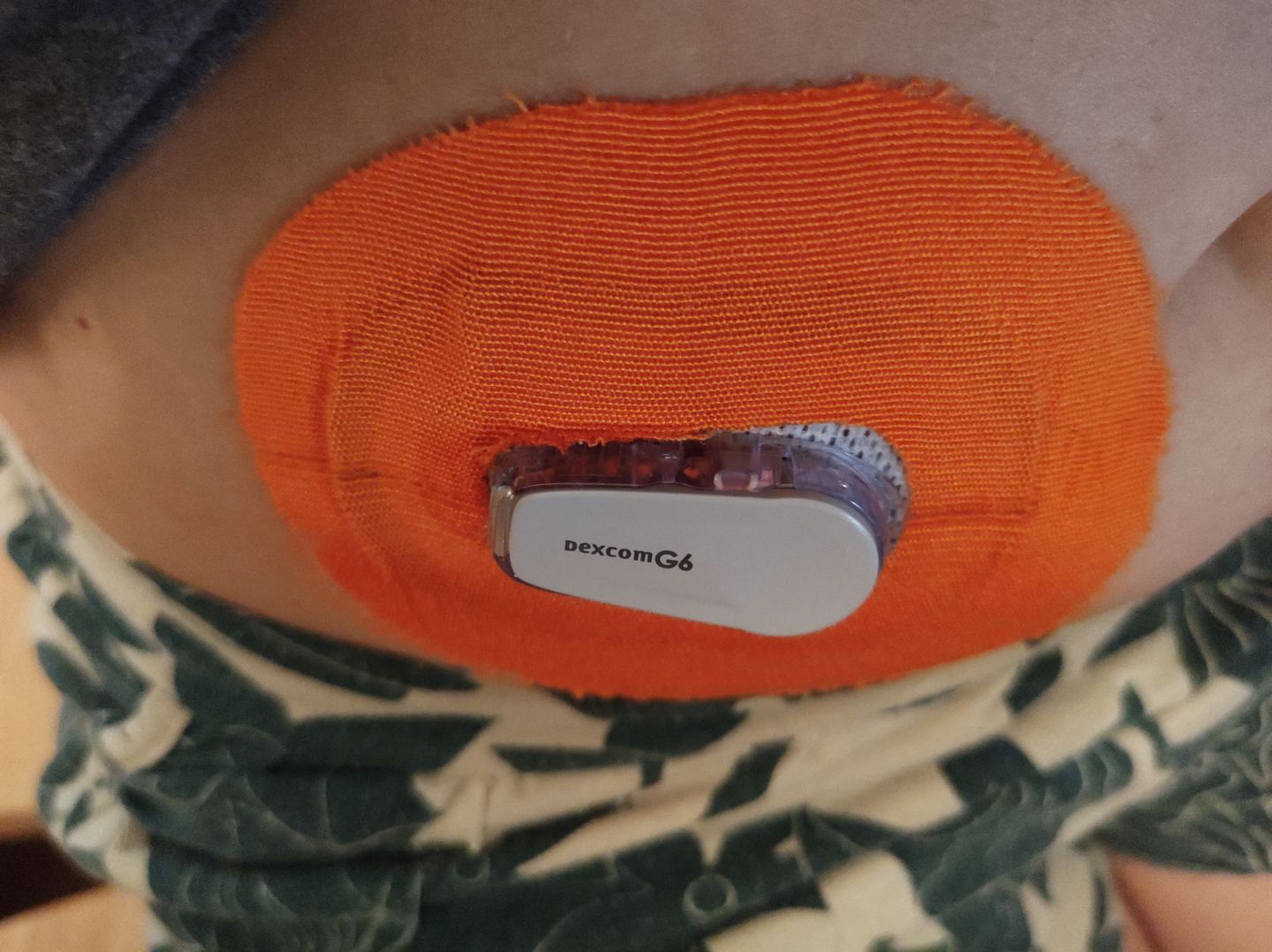 Customer photo review of Underlayer by FlexiArmor