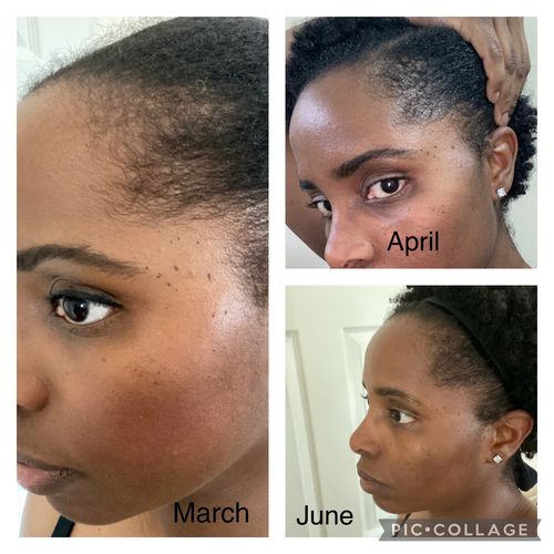 Customer photo review of Hair Growth Potion - Extra Strength