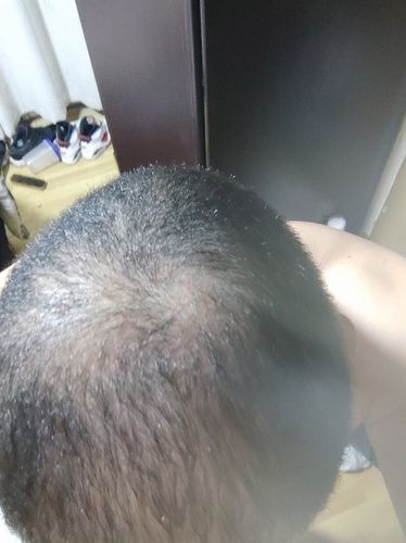 Customer photo review of Shampoo hidratante