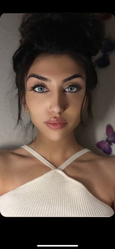 Customer photo review of Russian Blue Contact Lenses(12 months of use)