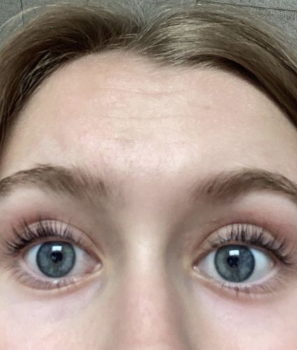 Customer photo review of SimplyLash kit