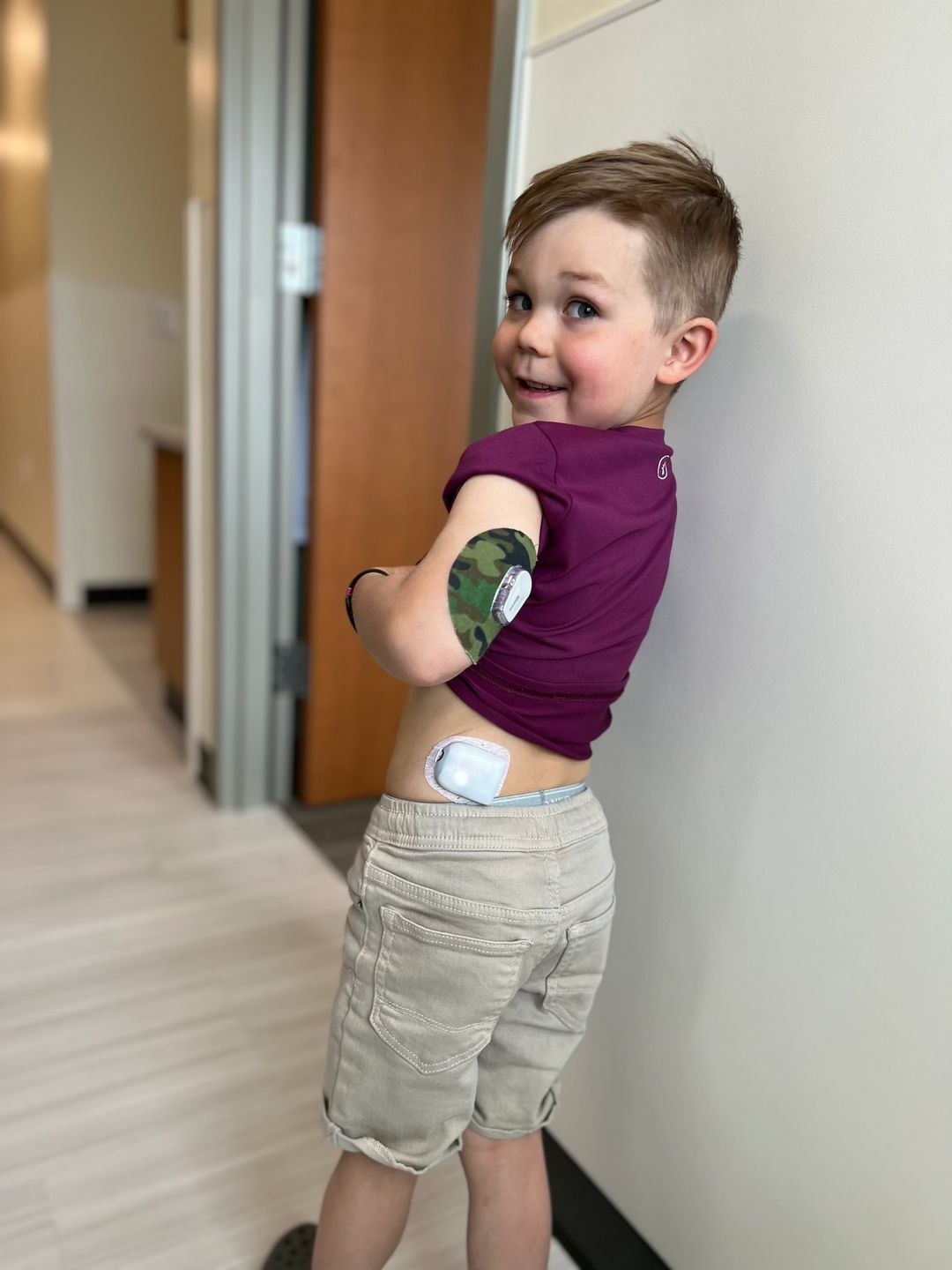 Customer photo review of Skin Grip Omnipod Adhesive Patches