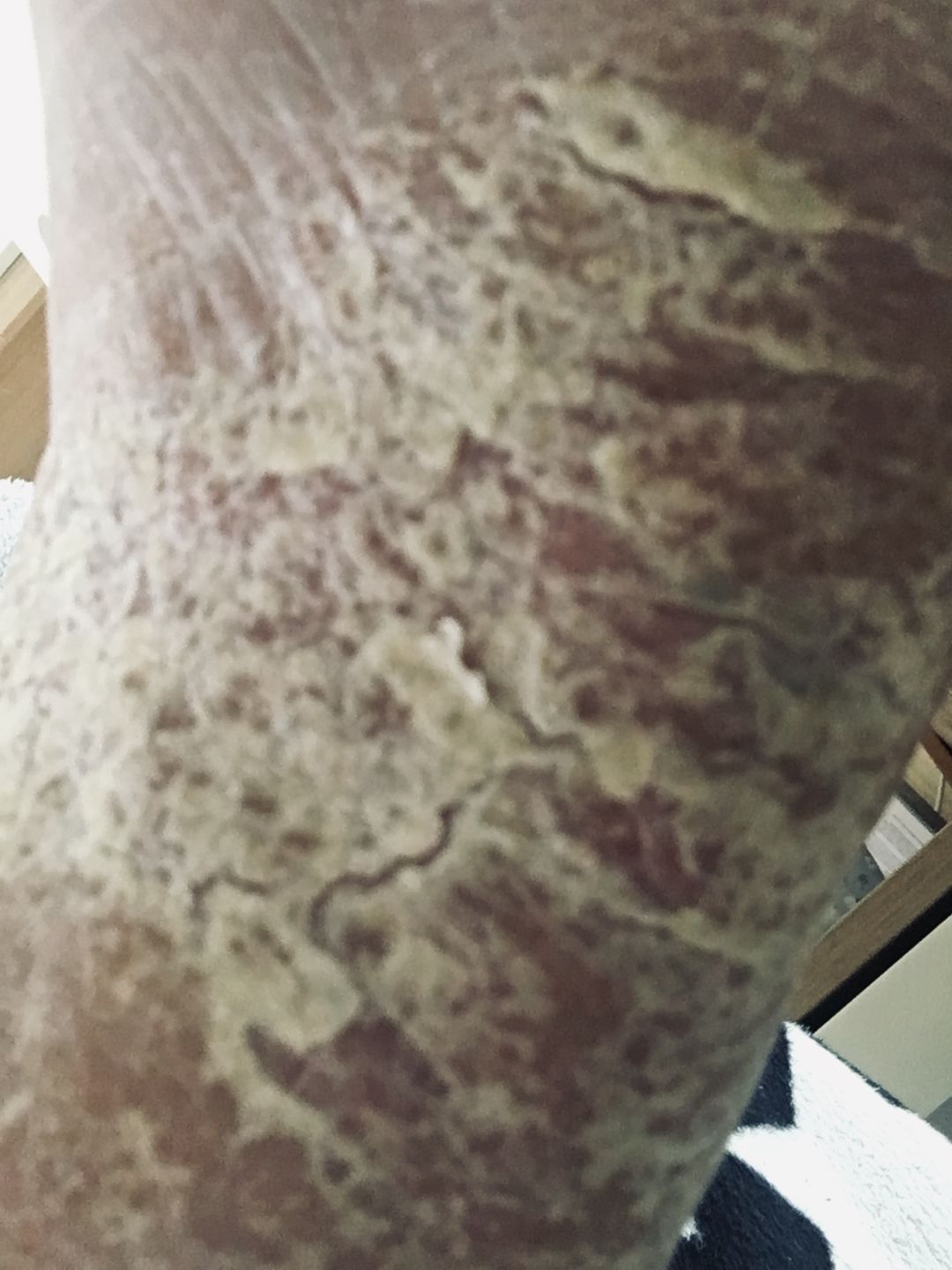 Customer photo review of Intensive Night Balm