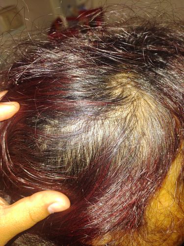Customer photo review of SHAMPOO ANTICASPA FORMATO BARRA