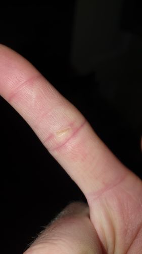 Customer photo review of Miracle Balm