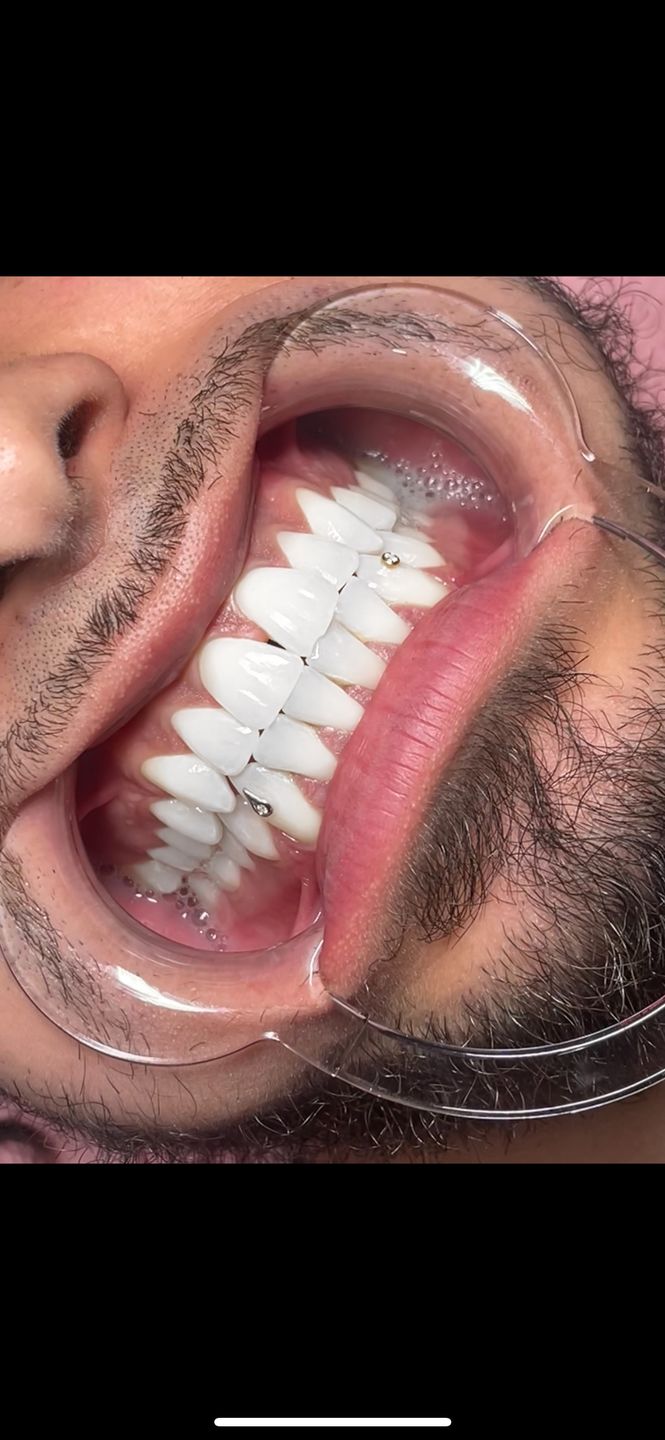 Customer photo review of Droplet w. Diamond White Gold 18-karat