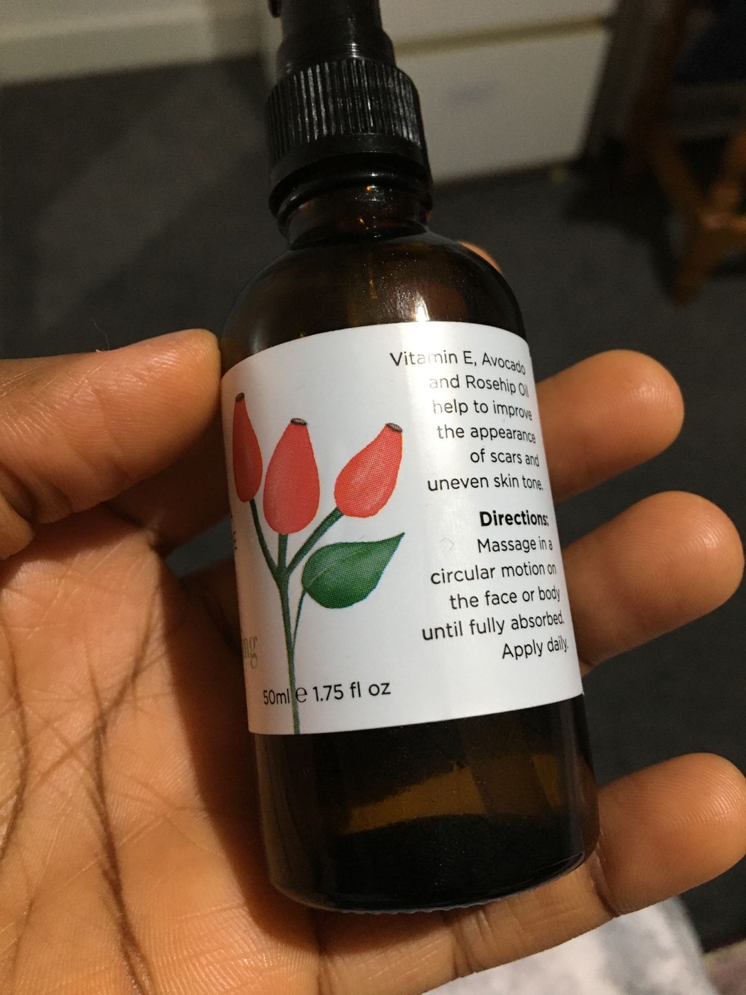 Customer photo review of Scar Minimising Oil