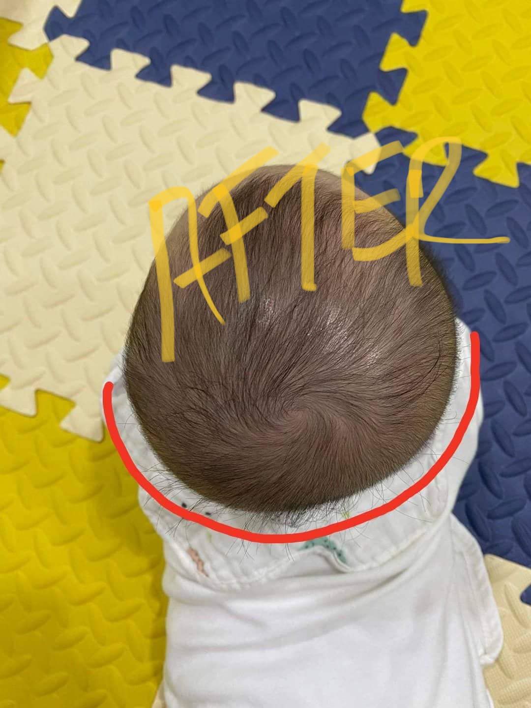 Customer photo review of BSB Head Shaping Pillow ( Upgrade.Ver )
