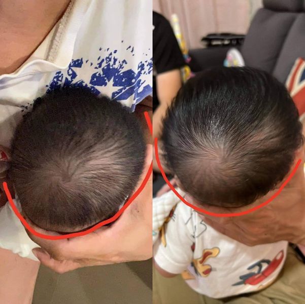 Customer photo review of BSB Head Shaping Pillow ( Upgrade.Ver )