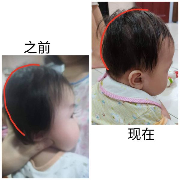 Customer photo review of BSB Head Shaping Pillow ( Upgrade.Ver )