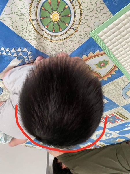 Customer photo review of BSB Head Shaping Pillow ( Upgrade.Ver )
