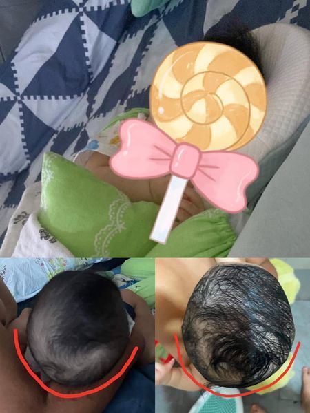 Customer photo review of BSB Head Shaping Pillow ( Upgrade.Ver )