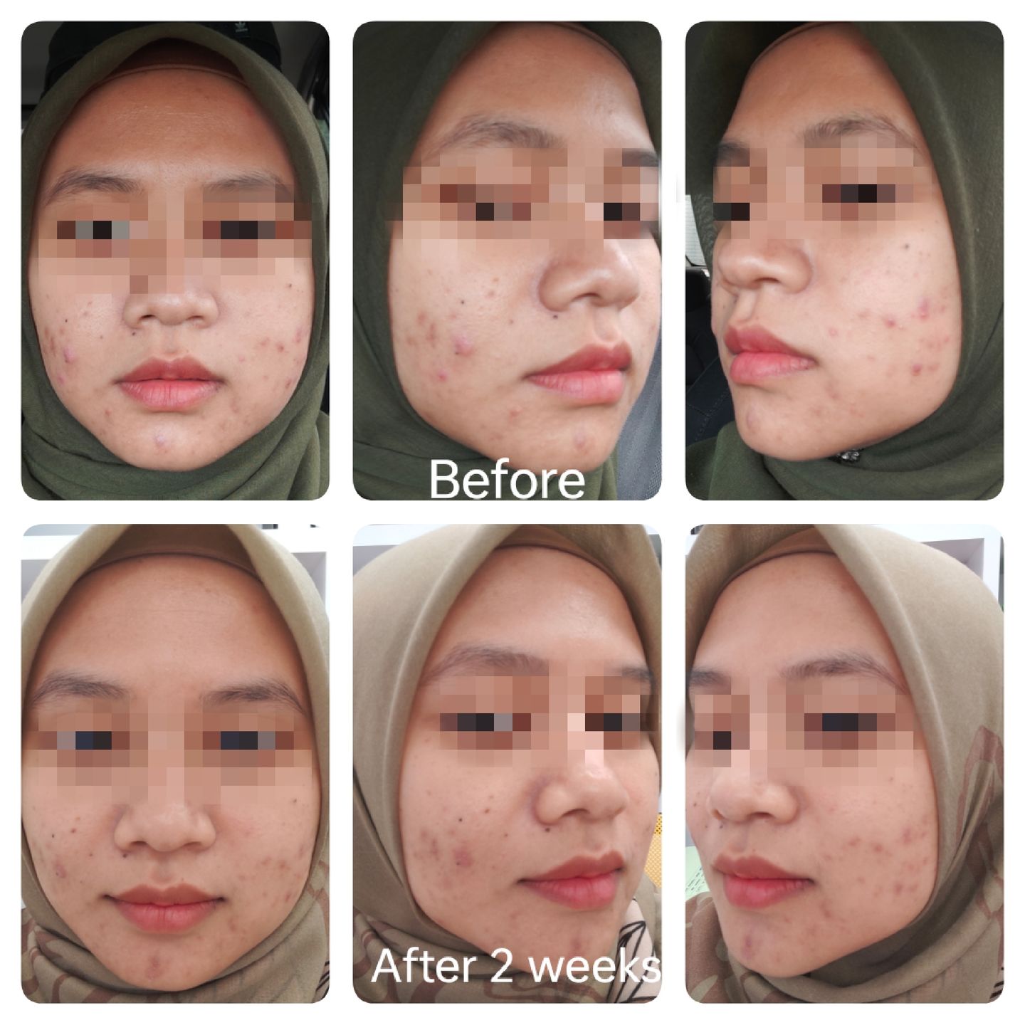 Customer photo review of GOLD FACE SET