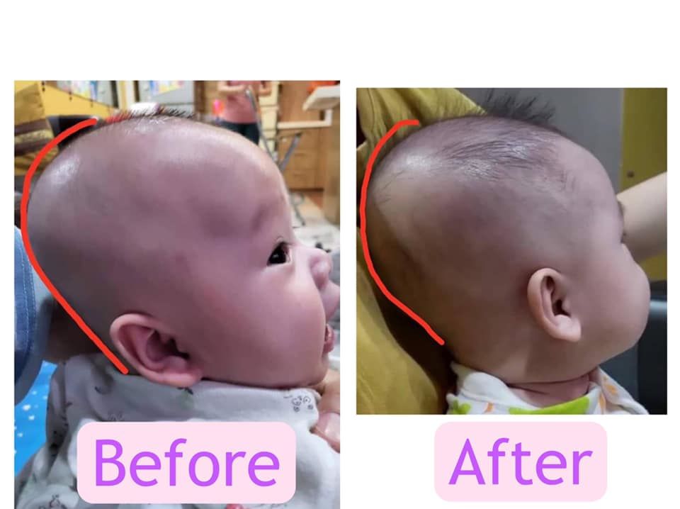Customer photo review of BSB Head Shaping Pillow ( Upgrade.Ver )
