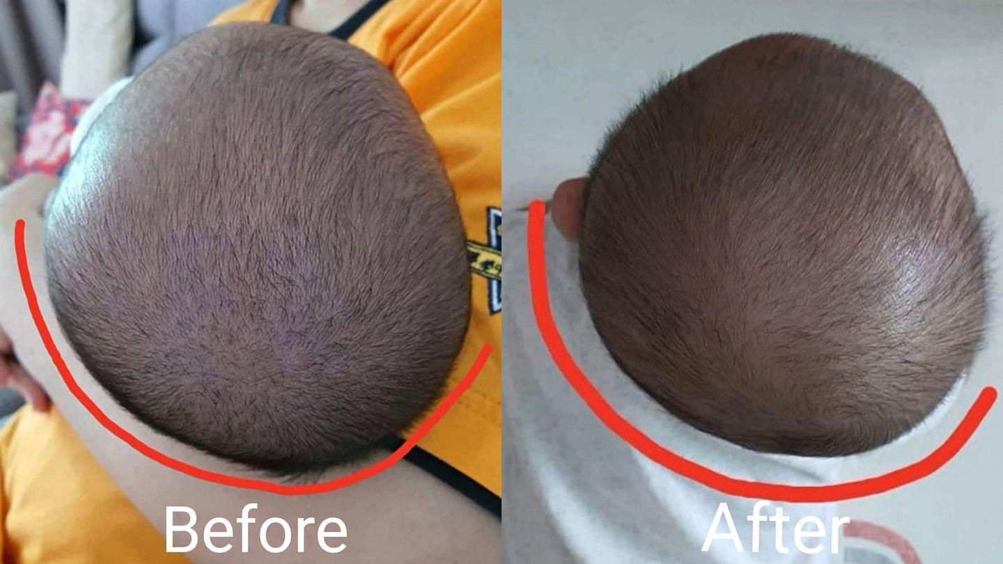 Customer photo review of BSB Head Shaping Pillow ( Upgrade.Ver )