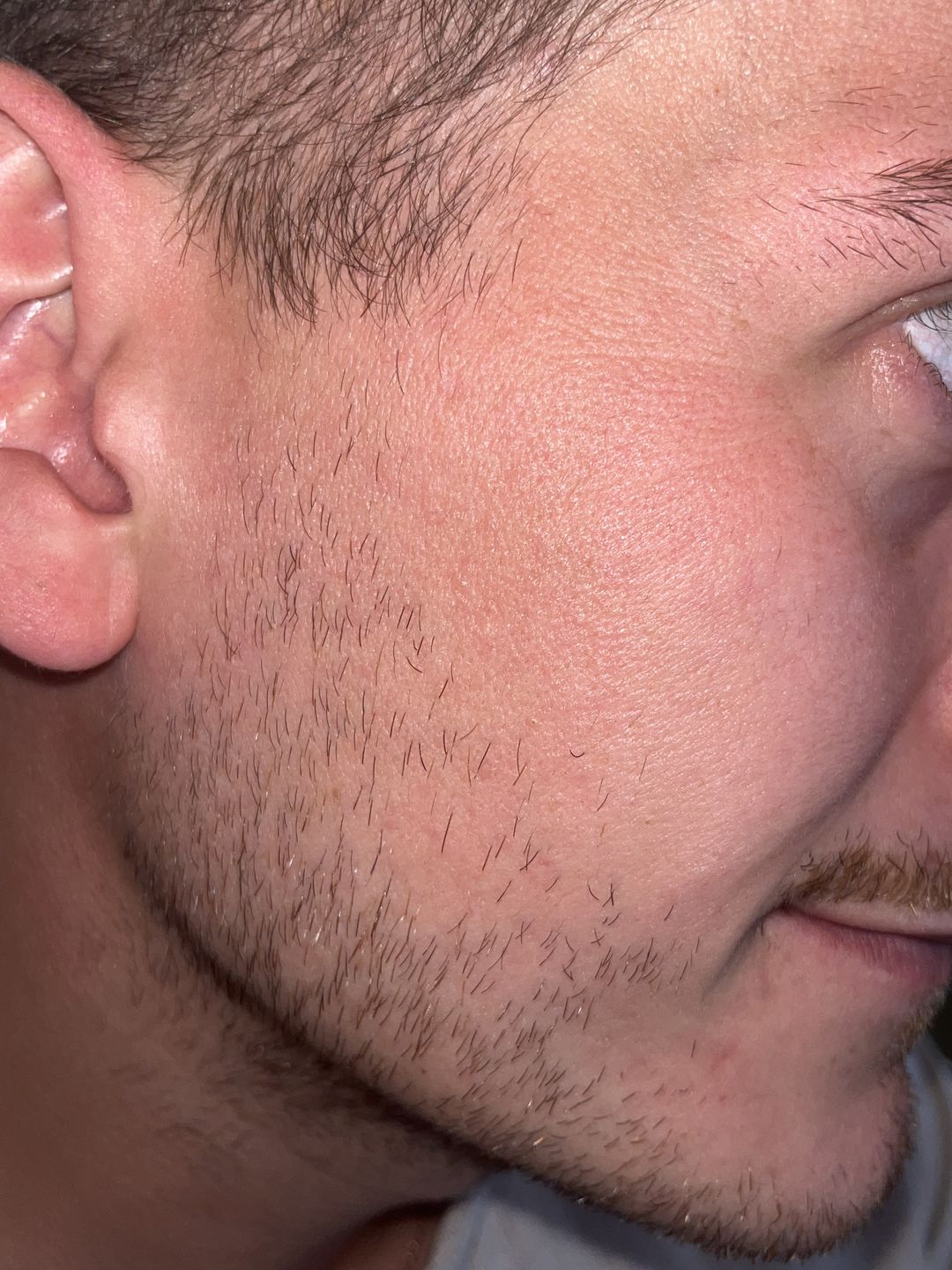 Customer photo review of Sleek Skin Serum 30ml