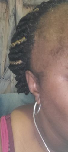 Customer photo review of Hair Regrowth Serum