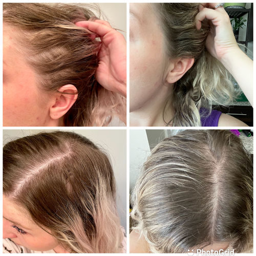 Customer photo review of Growth & Shine Hair Oil