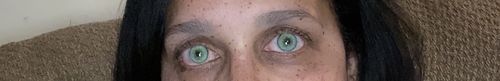 Customer photo review of Alpha Green Contact Lenses(12 months wear)