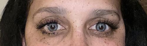 Customer photo review of Bloom Blue Contact Lenses(12 months wear)