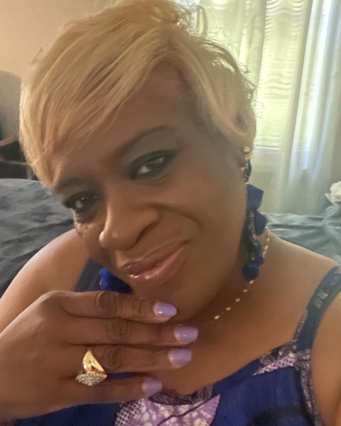 Customer photo review of A-Dream Brightening Eye Cream