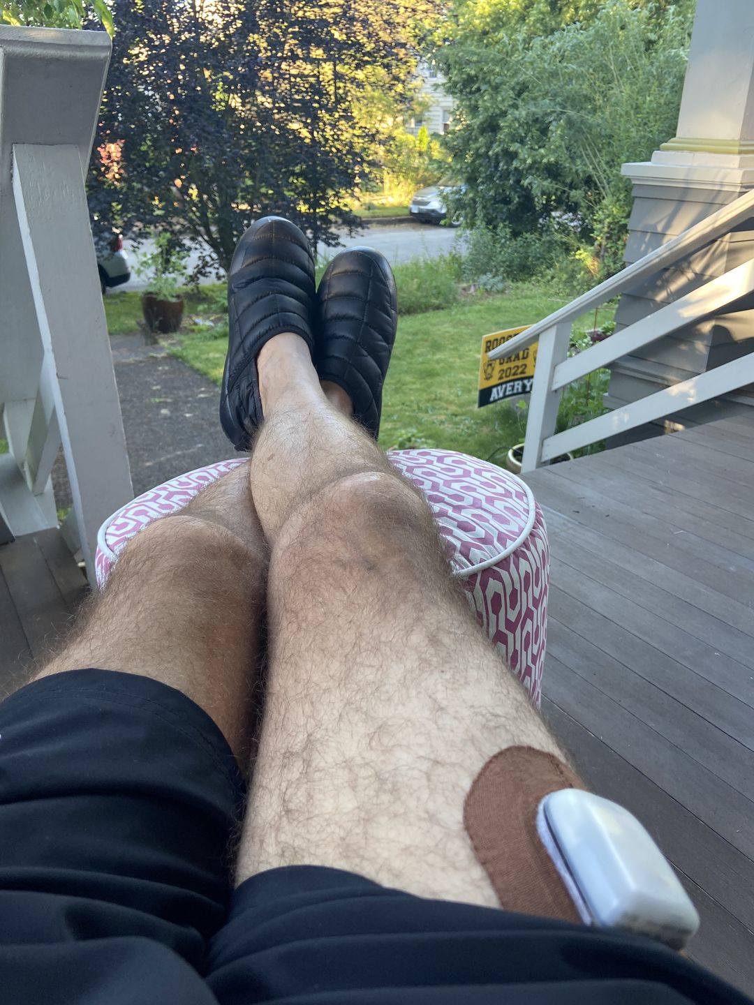 Customer photo review of Skin Grip Omnipod Adhesive Patches