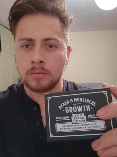 Customer photo review of Bálsamo para Crecimiento de Barba y Bigote Extra Fuerte Minoxidil 15% 100 ml
