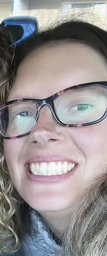 Customer photo review of bedrō Whitening