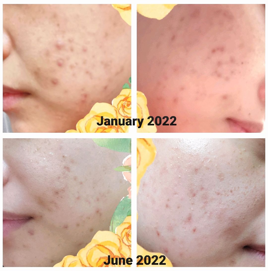 Customer photo review of GOLD FACE SET