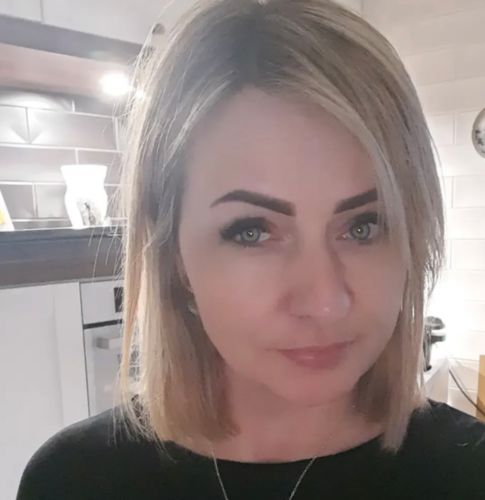 Customer photo review of Kanami Blue Colored Contact Lenses