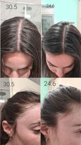 Customer photo review of Growth & Shine Hair Oil