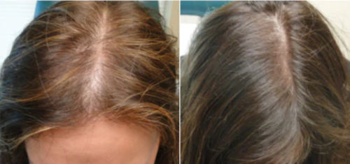 Customer photo review of HårReparation™ Naturlig Hår Reparations Behandling