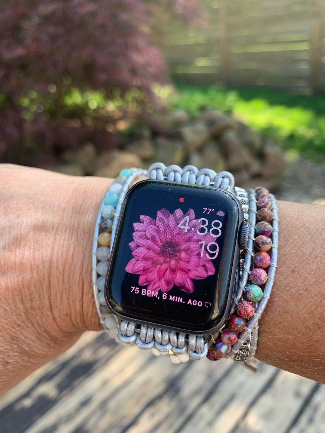 Customer photo review of Healing Turquoise Protection Apple Watch Strap
