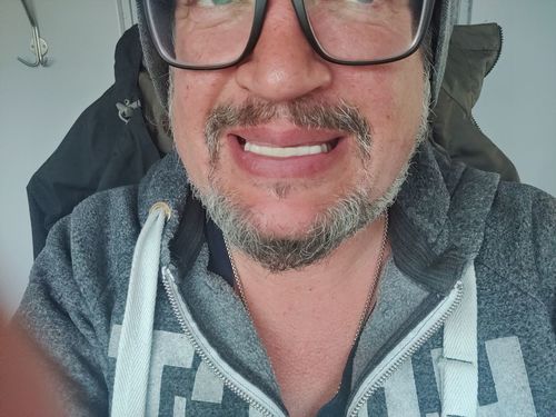 Customer photo review of Teeth-Veneer 2.0