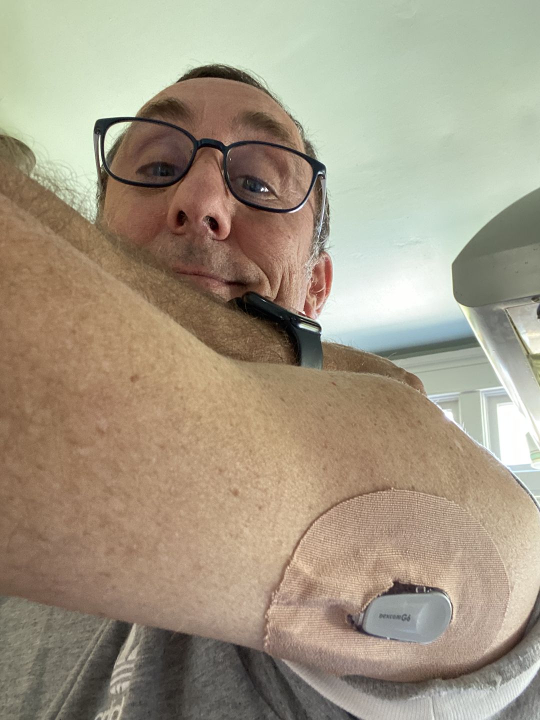 Customer photo review of Skin Grip Omnipod Adhesive Patches