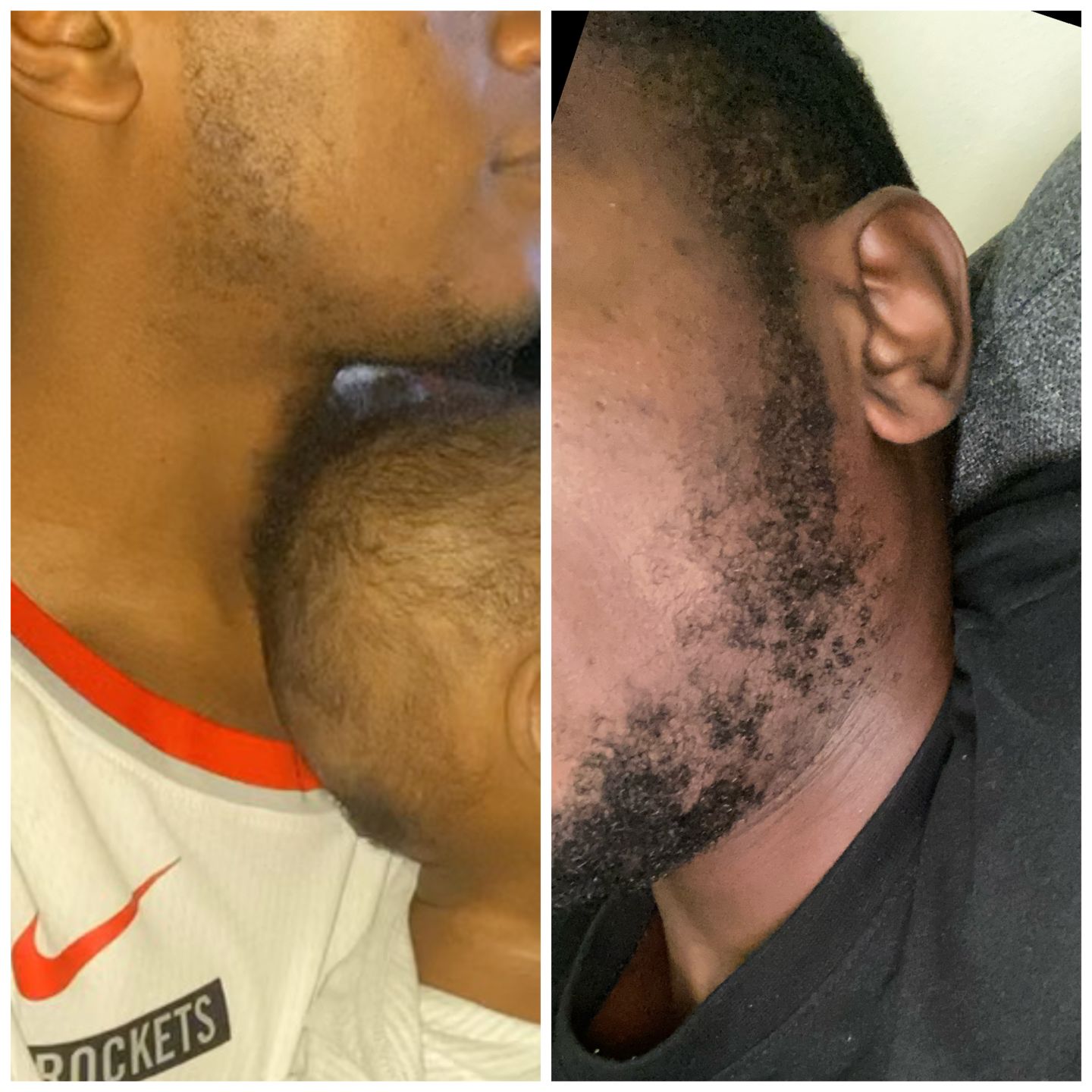 Customer photo review of Hair Growth Oil