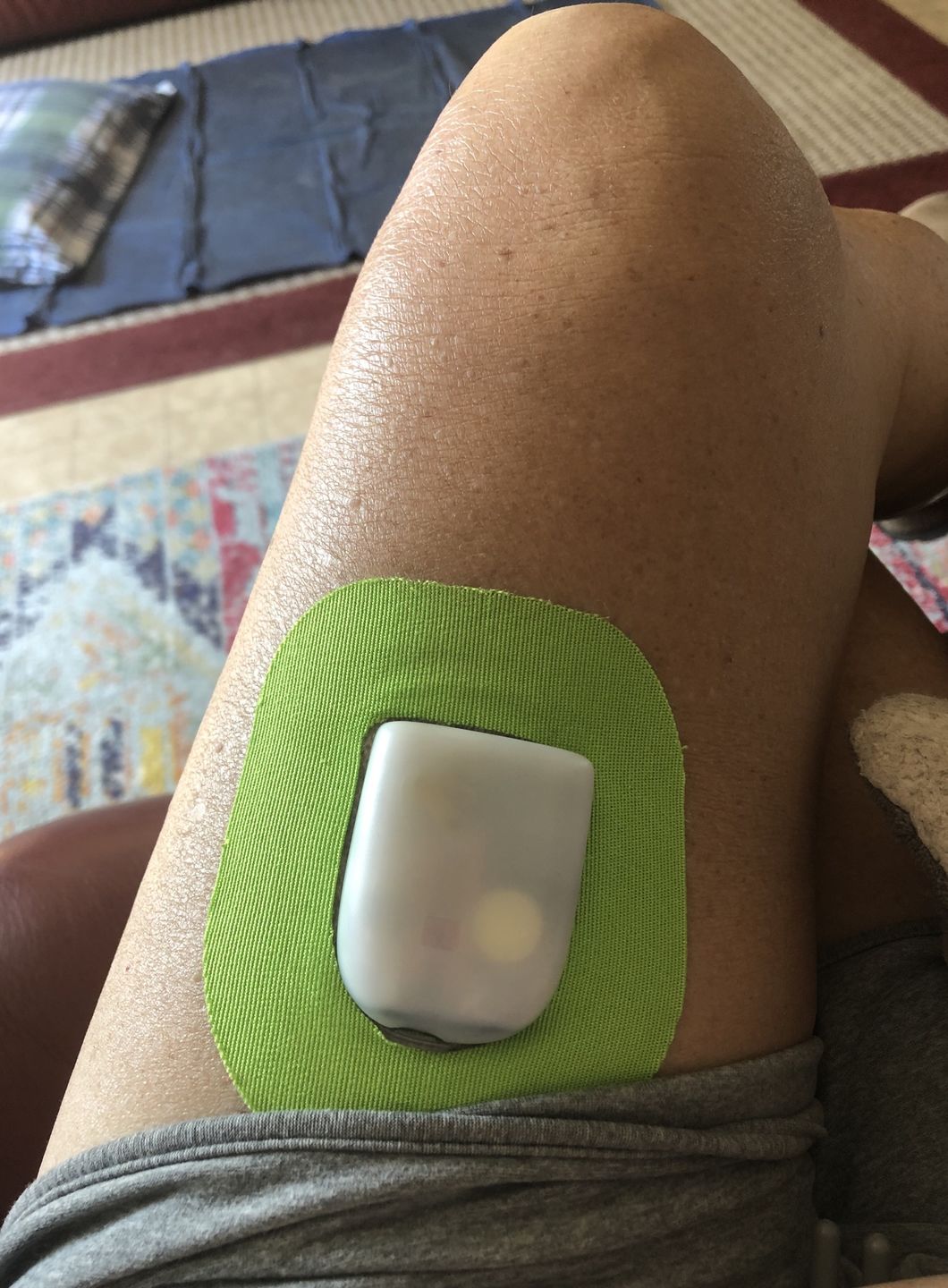Customer photo review of Skin Grip Omnipod Adhesive Patches