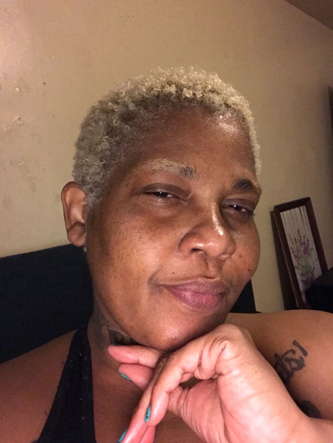 Customer photo review of Omic LightenUp Anti-Aging Clarifying Gel - 30g / 1 Oz
