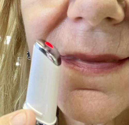 Customer photo review of EvenSkyn® Venus: Premium Eyelid Anti-Aging Device