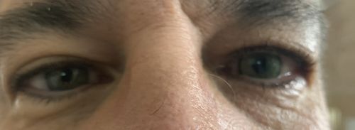 Customer photo review of Norko Green Contact Lenses(12 months wear)