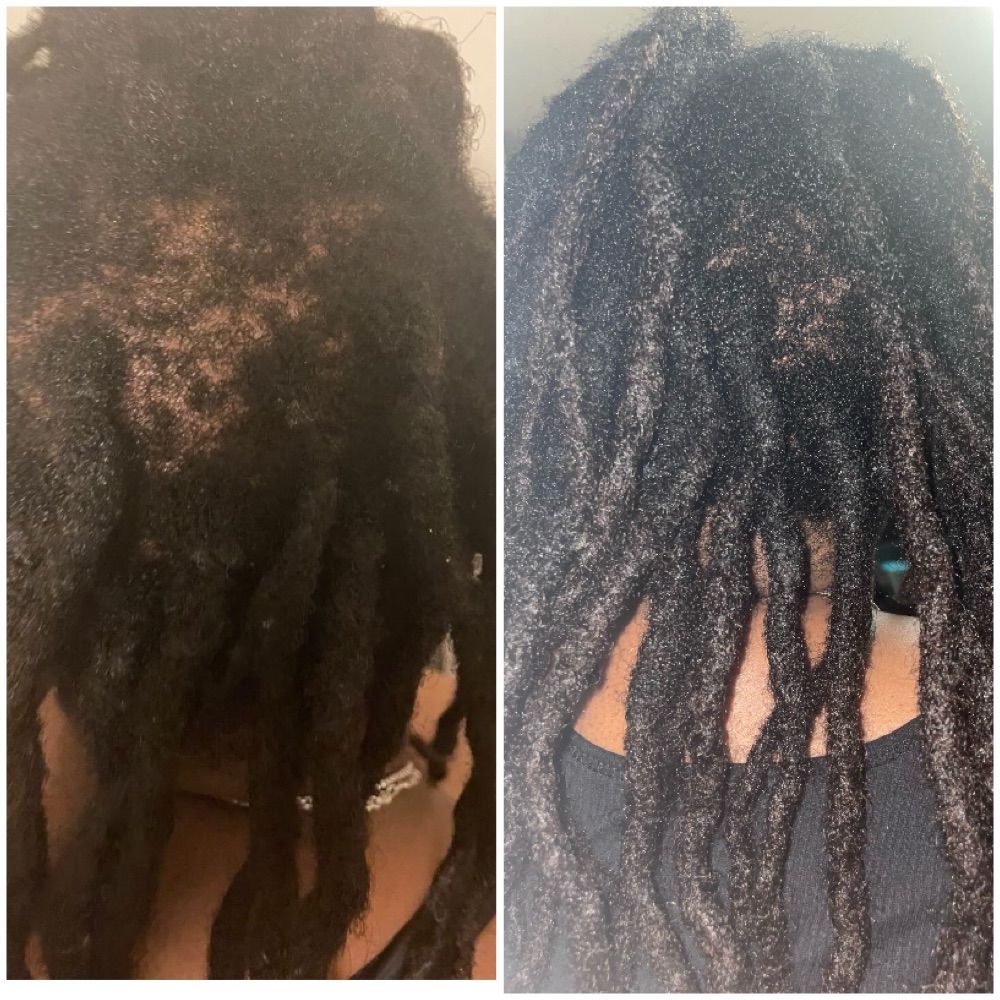 Customer photo review of Hydrated and Healthy Bundle