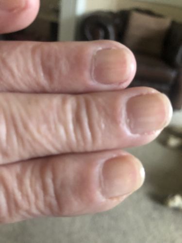 Customer photo review of Base coat "Studios Didier", Strong Fiber, 8ml